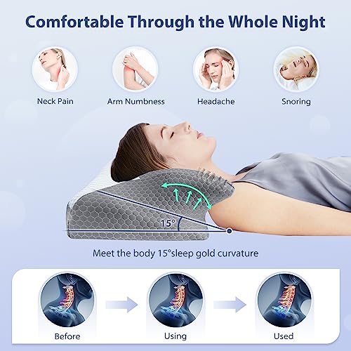  HOMCA Cervical Pillow - Ergonomic Memory Foam Pillow For Neck And Shoulder Pain Relief With Cooling Ice Silk Pillowcase, Orthopedic Neck Bed Pillow For Side, Back And Stomach Sleepers