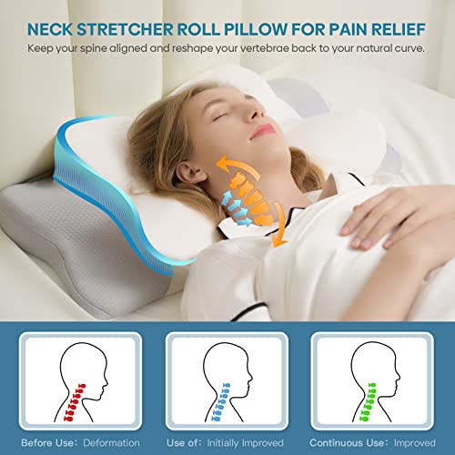  Cervical Pillow For Neck & Shoulder Pain Relief Sleeping - Ergonomic Contour Pillows - Memory Foam Pillow For Side, Back & Stomach Sleepers - Queen Size
